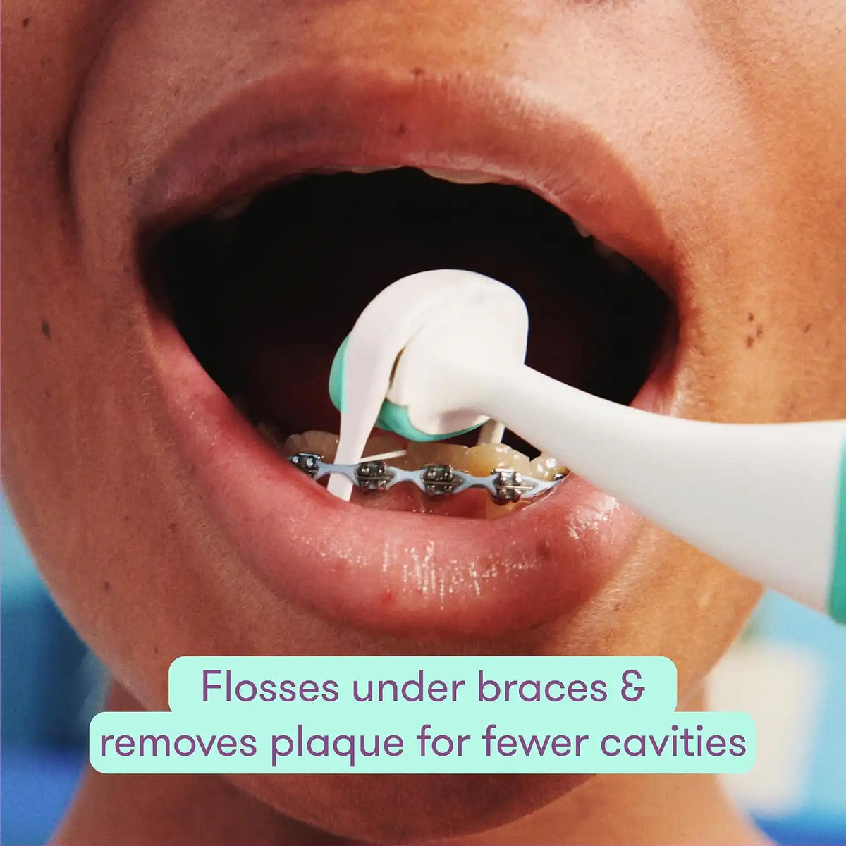 Frida for Kids Orthodontic Flosser Heads, Braces Floss Refills, 30 Ct